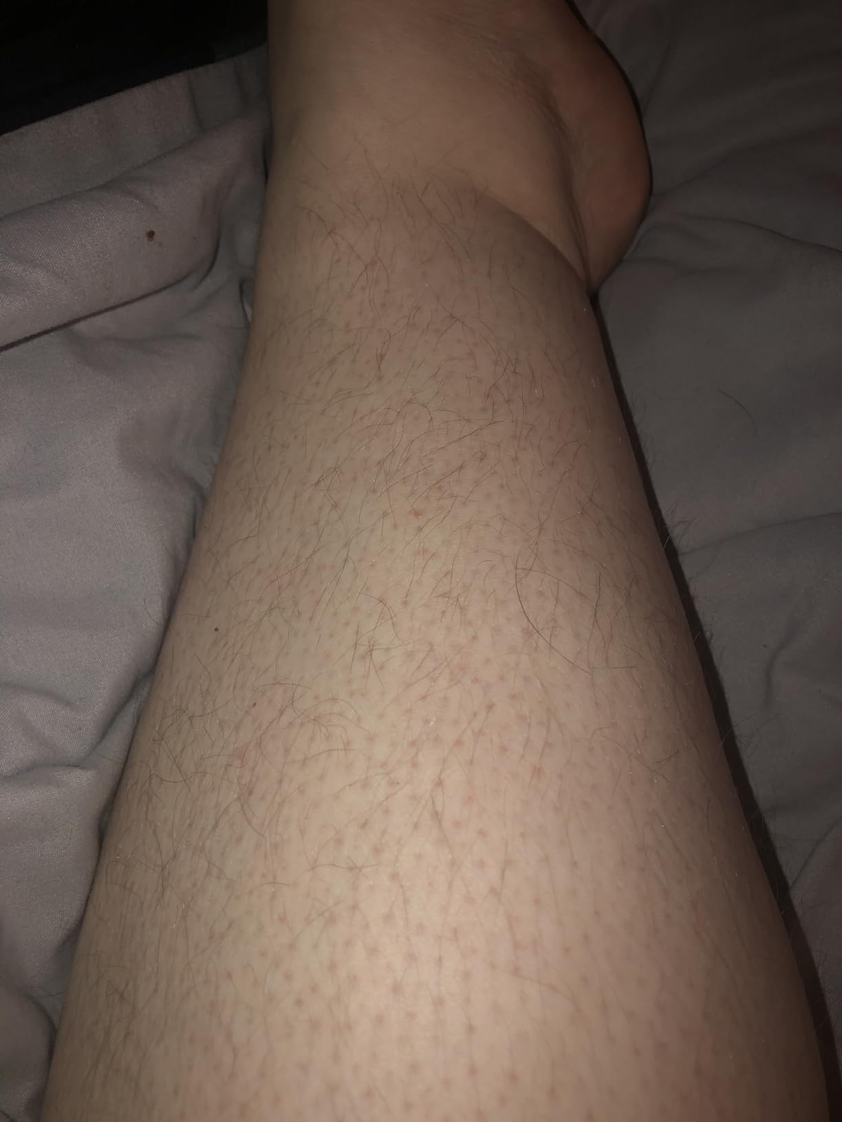Philips SatinShave Essential Women’s Wet & Dry Electric Shaver for Legs & Body, Cordless, with Hypoallergenic Foil, HP6306/50 customer photo 1
